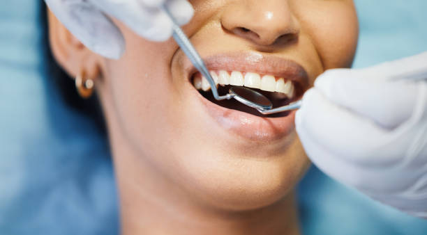 Best Emergency Treatment for Toothache in Bradford Woods, PA