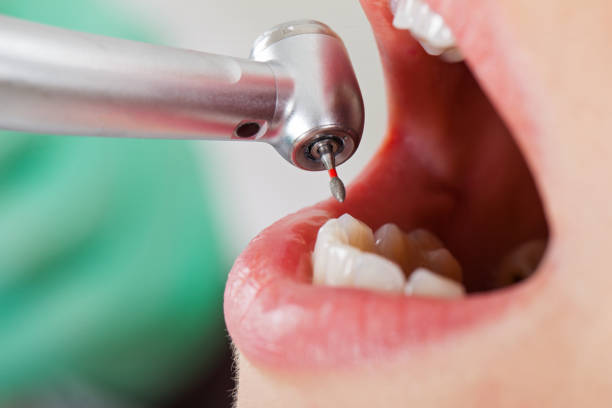 Best Emergency Dental Care for Trauma or Injury in Bradford Woods, PA